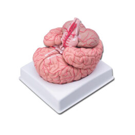Creier-cu-artere-1