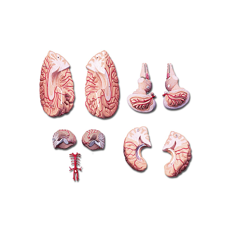 Creier-cu-artere-2